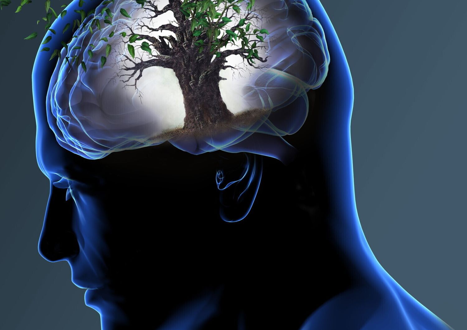 &nbsp;Cervello Alzheimer