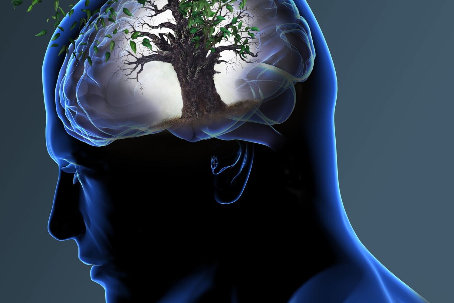 &nbsp;Cervello Alzheimer