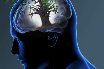 &nbsp;Cervello Alzheimer