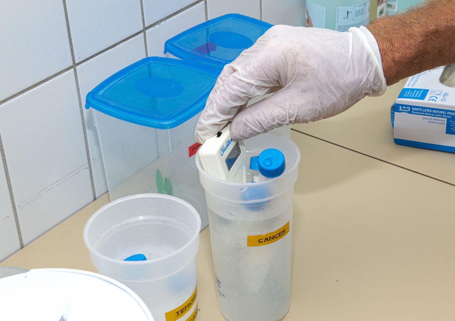 cerotto-nanoaghi-biopsie-tumore-diagnosi-non-invasiva