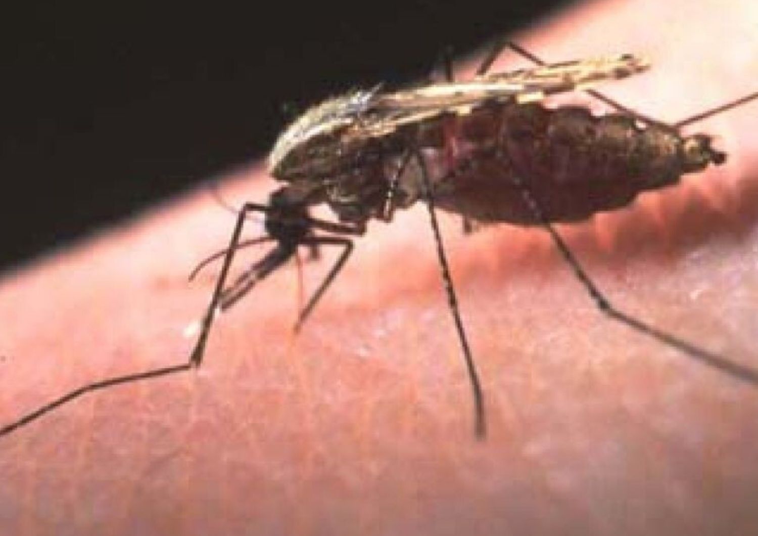 Malaria
