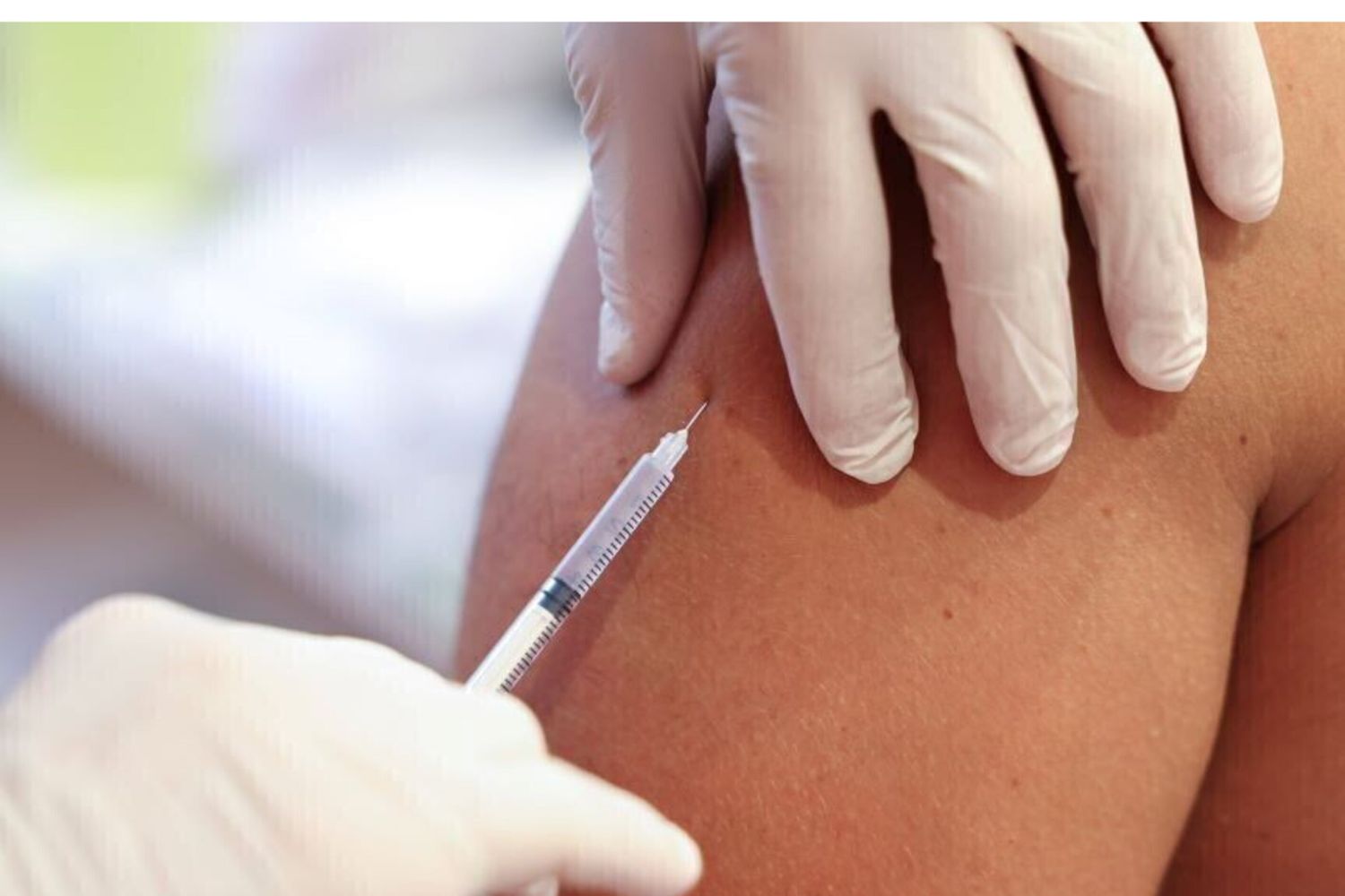 Il vaccino contro l’herpes zoster riduce del 23% il rischio di ictus e patologie cardiache