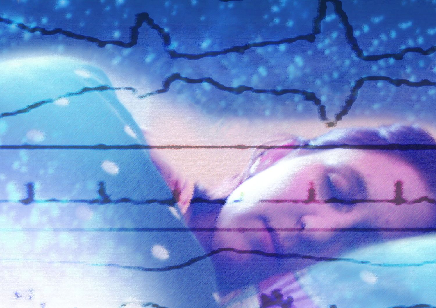 quando dormiano cerevello attivo