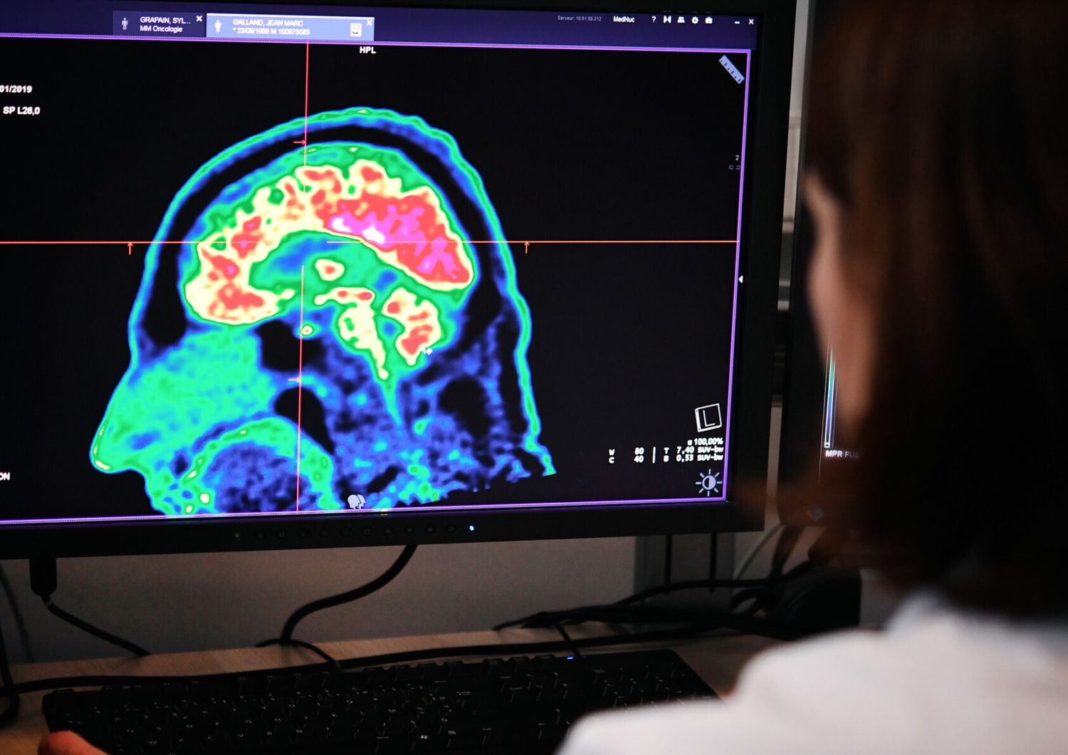 Cervello, intelligenza artificiale&nbsp;