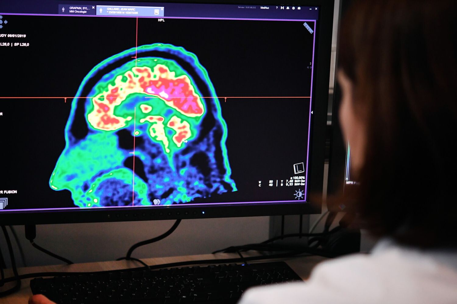 Cervello, intelligenza artificiale&nbsp;