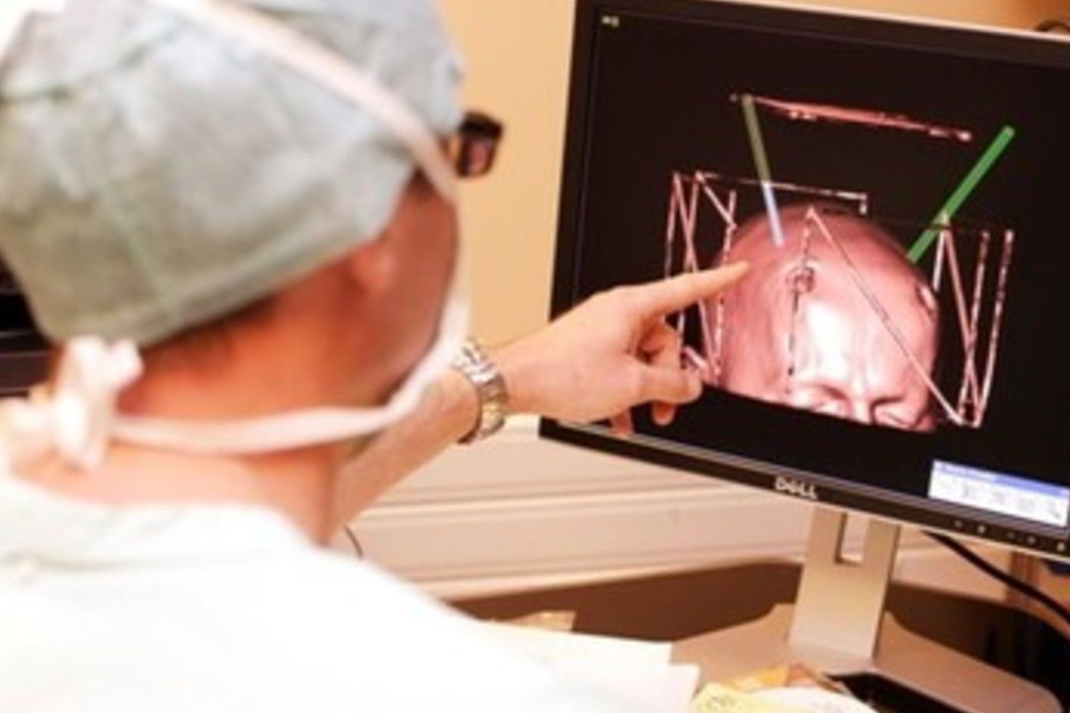 Cervello studio neurologia