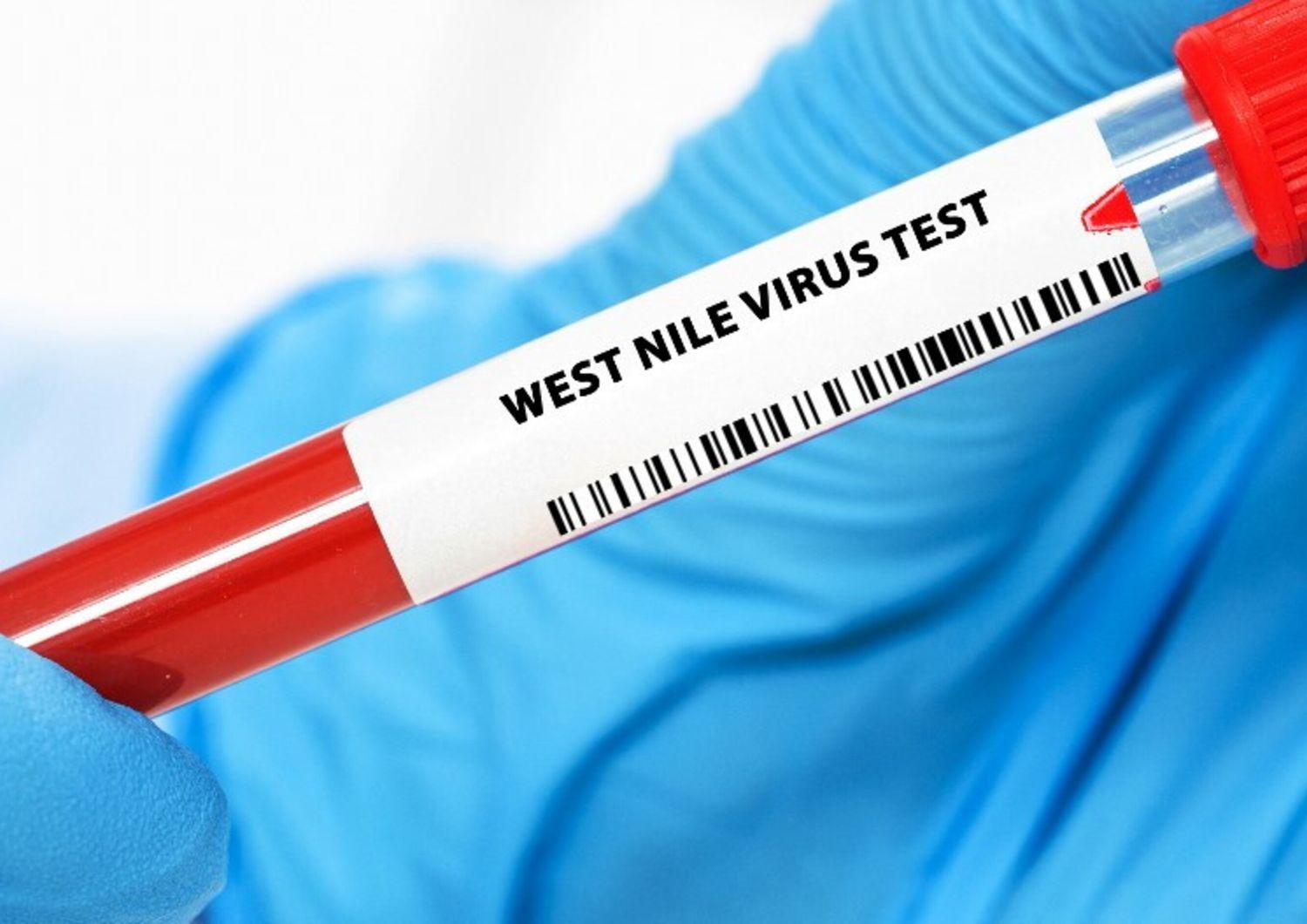 west-nile-morte-fondi-casi-lazio-zanzare-prevenzione