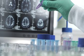 Demenza, studi sul comportamento del cervello