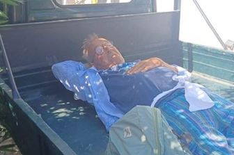 Stromboli non ha ambulanze. La disavventura di un giornalista ferito e soccorso in moto Ape