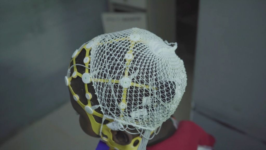 En Tanzanie, la coopération italienne bâtit un réseau pour lutter contre la stigmatisation de l'épilepsie