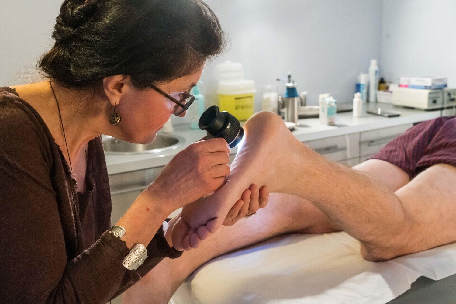 Melanoma, in 3 casi su 4 i più pericolosi sono i nei nuovi