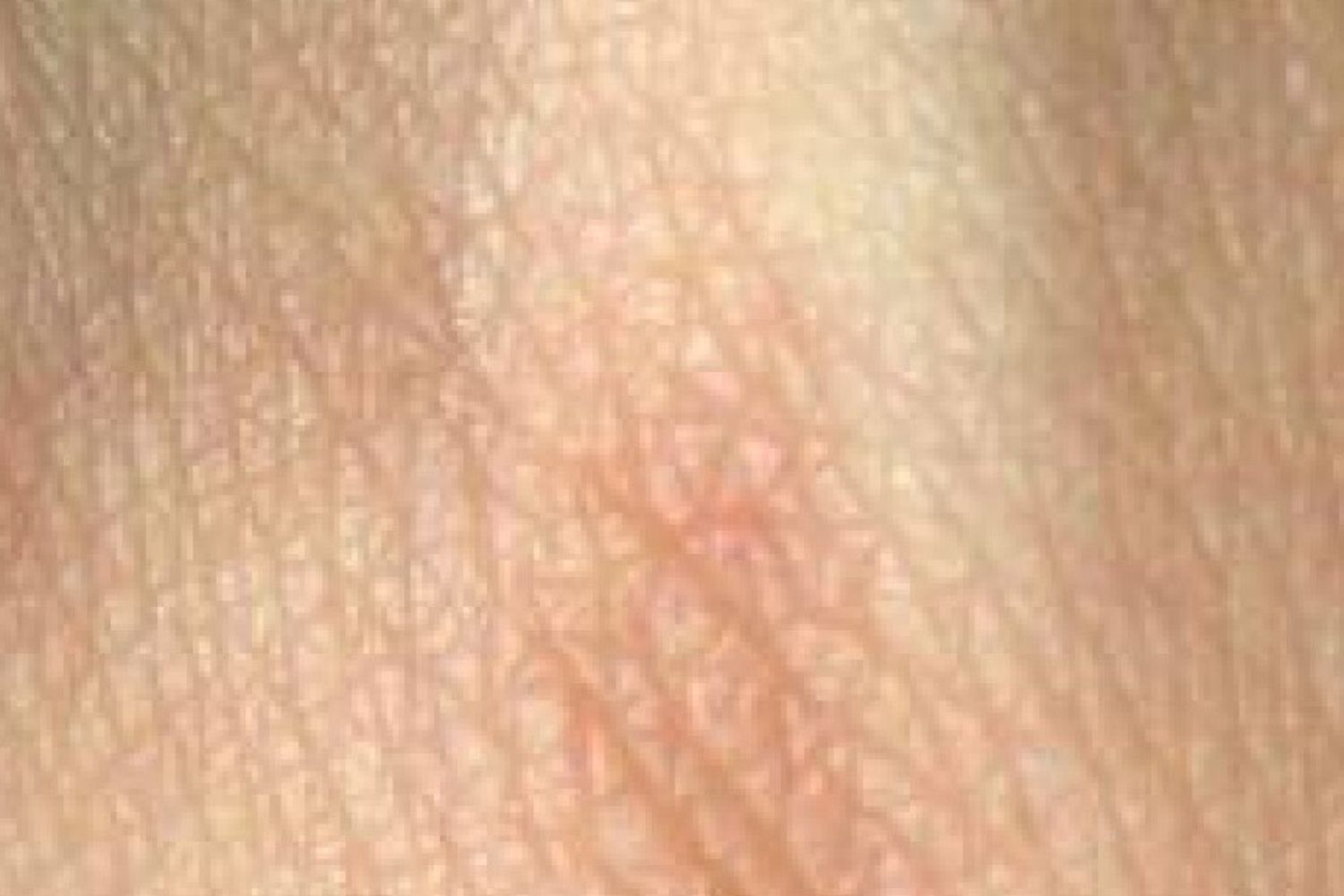 Scoperto il gene da cui dipende il colore della pelle e dei capelli