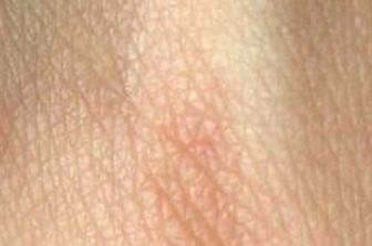 Scoperto il gene da cui dipende il colore della pelle e dei capelli