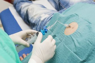 Menopausa e sclerosi multipla, c’è una correlazione