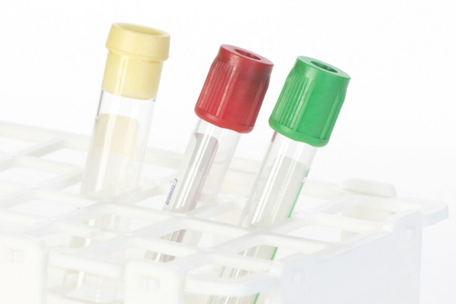 Colesterolo, le nuove linee guida