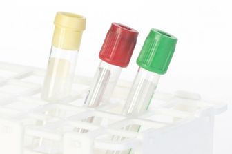 Colesterolo, le nuove linee guida