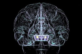 Nuovo esame per rilevare il Parkinson