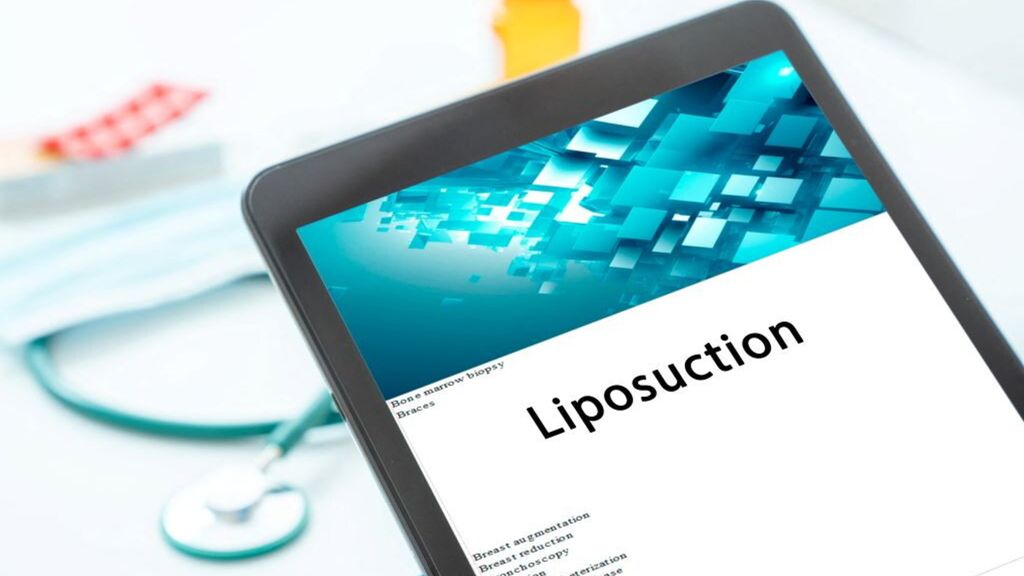 Liposuzione