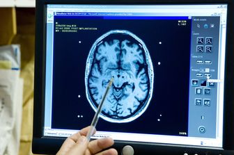 Una radiografia di un cervello
