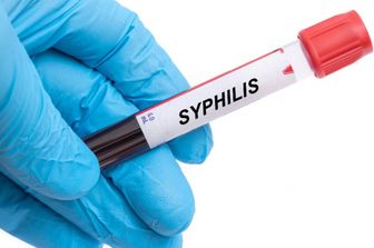 Sifilide