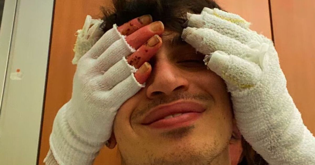 Eleonora Palmieri racconta Crans Montana con le sue cicatrici