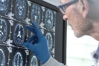 risonanza magnetica del cervello