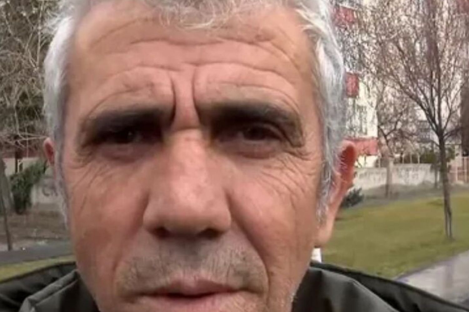 "Somiglio a Jeffrey Epstein, la mia vita è un inferno": il dramma del sosia turco che vuole cambiare volto