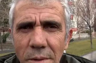 "Somiglio a Jeffrey Epstein, la mia vita è un inferno": il dramma del sosia turco che vuole cambiare volto