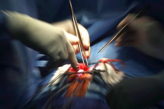 Operazione al cuore