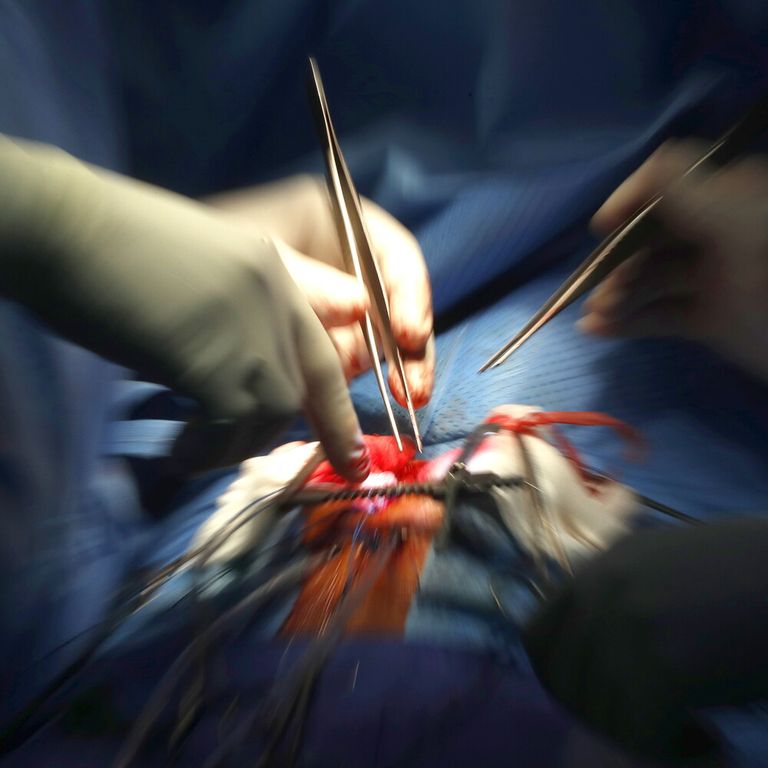 Operazione al cuore