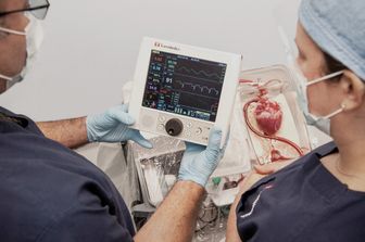 Contenitori per il trasporto degli organi