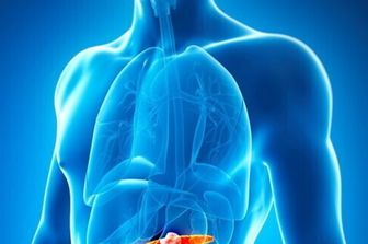 cancro tumore pancreas (afp)