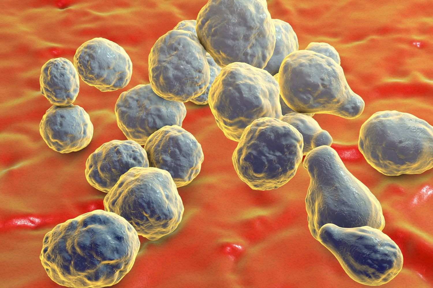 Il meningococco della meningite