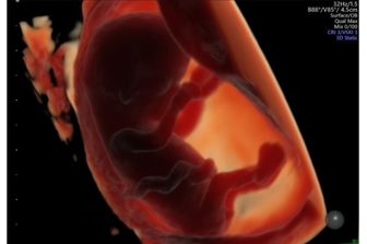 I cibi ultra-processati riducono la fertilità maschile e lo sviluppo dell'embrione