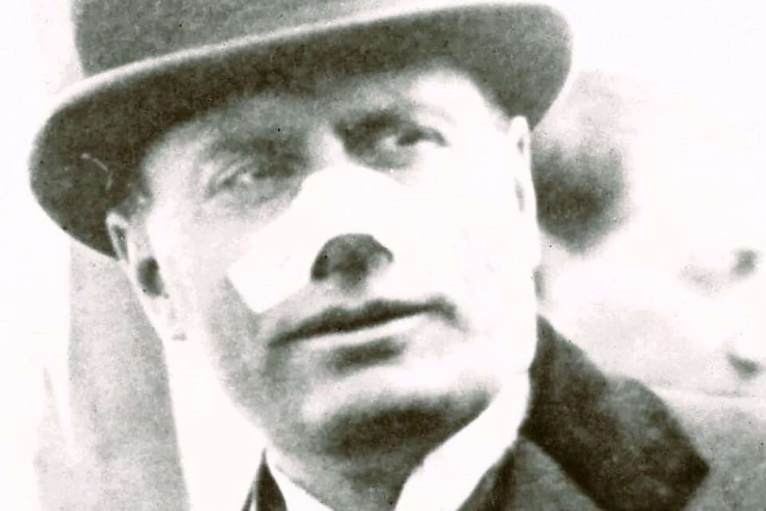 Mussolini ferito al naso