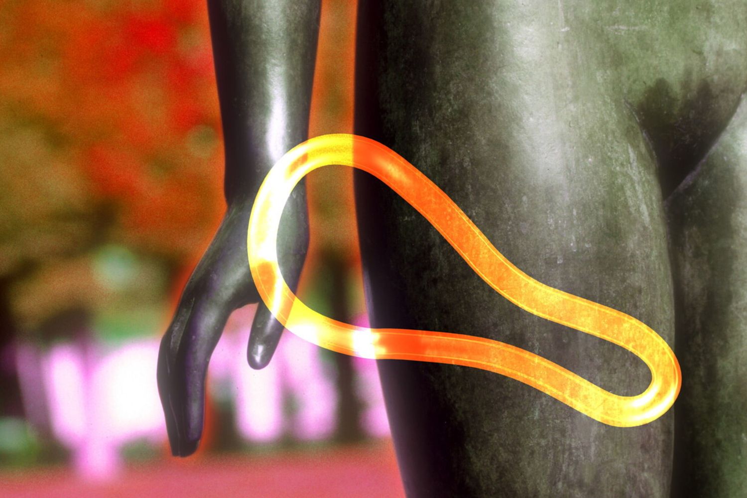 &nbsp;Annovera, contraccettivo&nbsp;