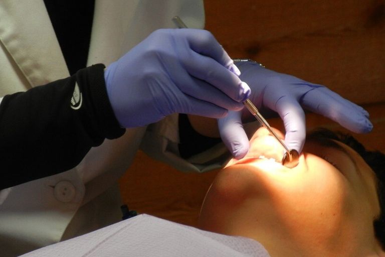 &nbsp;dentista odontoiatra igiene dentale denti - pixabay