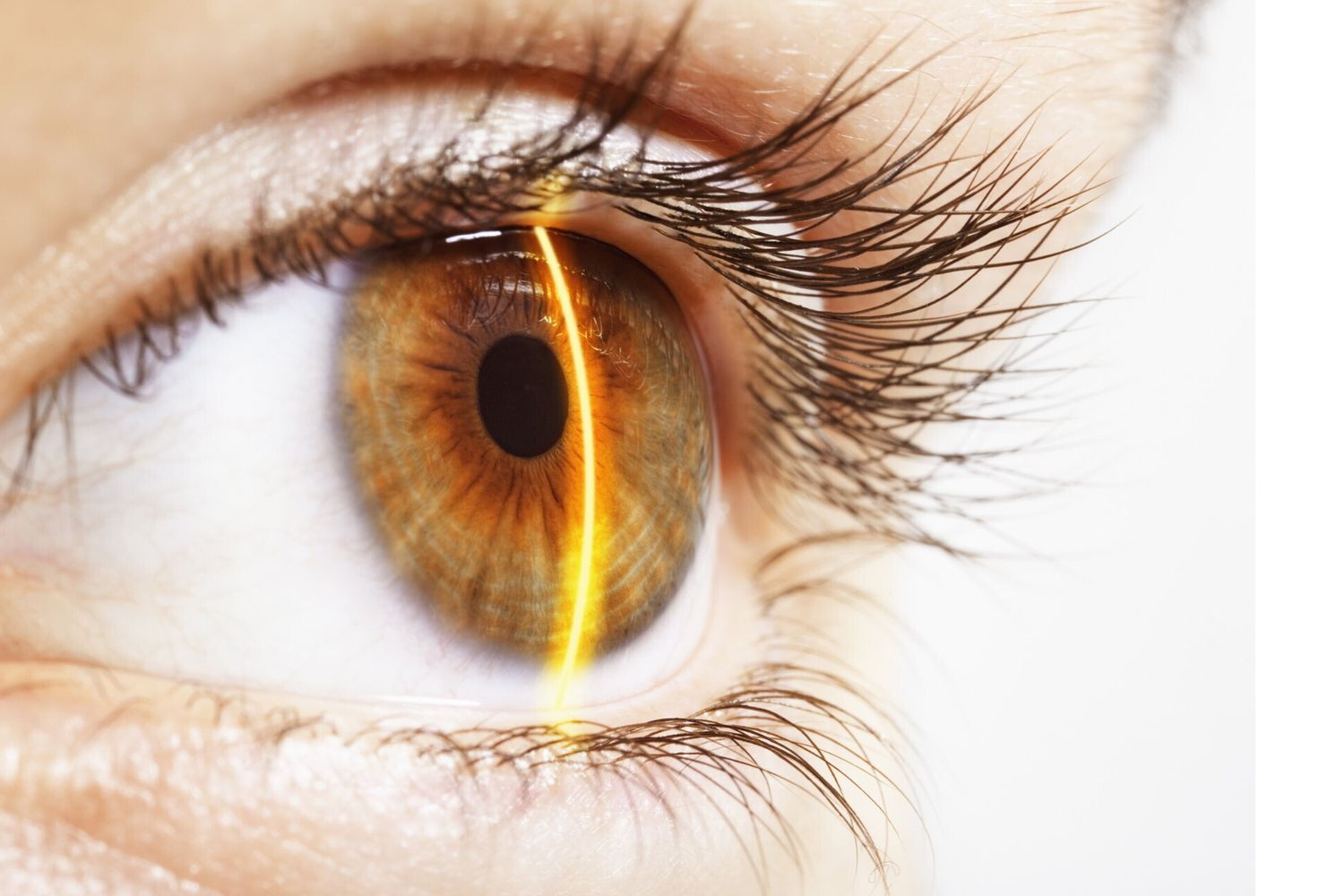 Tecnologia di ultima generazione per la chirurga dell'occhio all'Irccs di Negrar