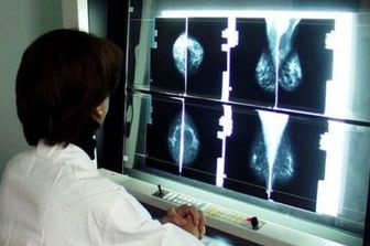 Radiografie di un tumore