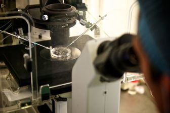 &nbsp;Biopsia, analisi dei tumori
