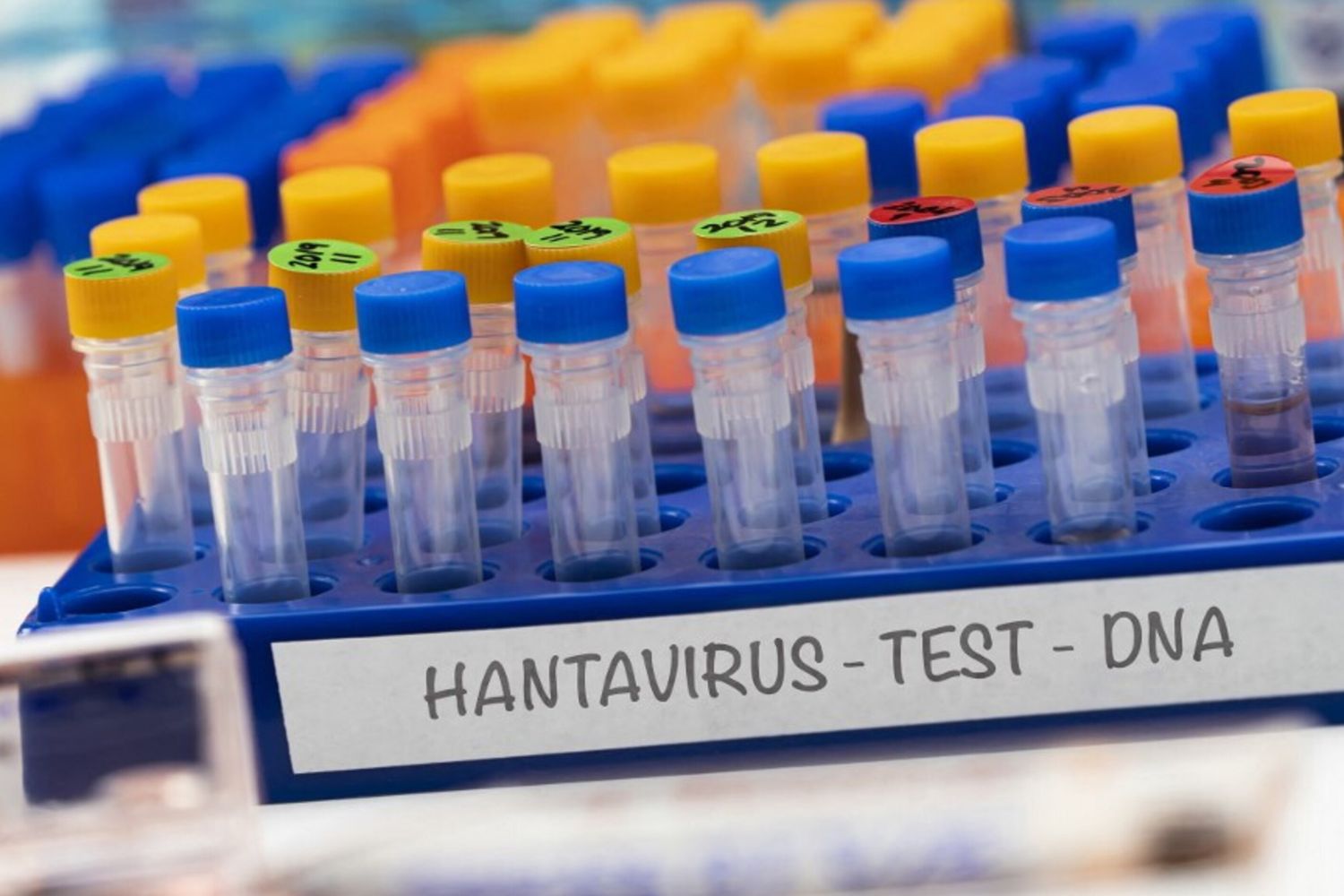 Test hantavirus