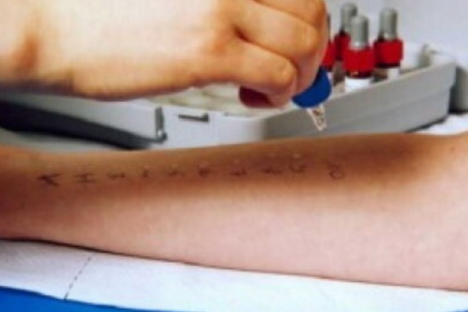 Un italiano su 2 soffre di celiachia, allergie o intolleranze alimentari