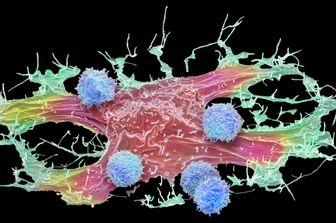 Tumori-cancro