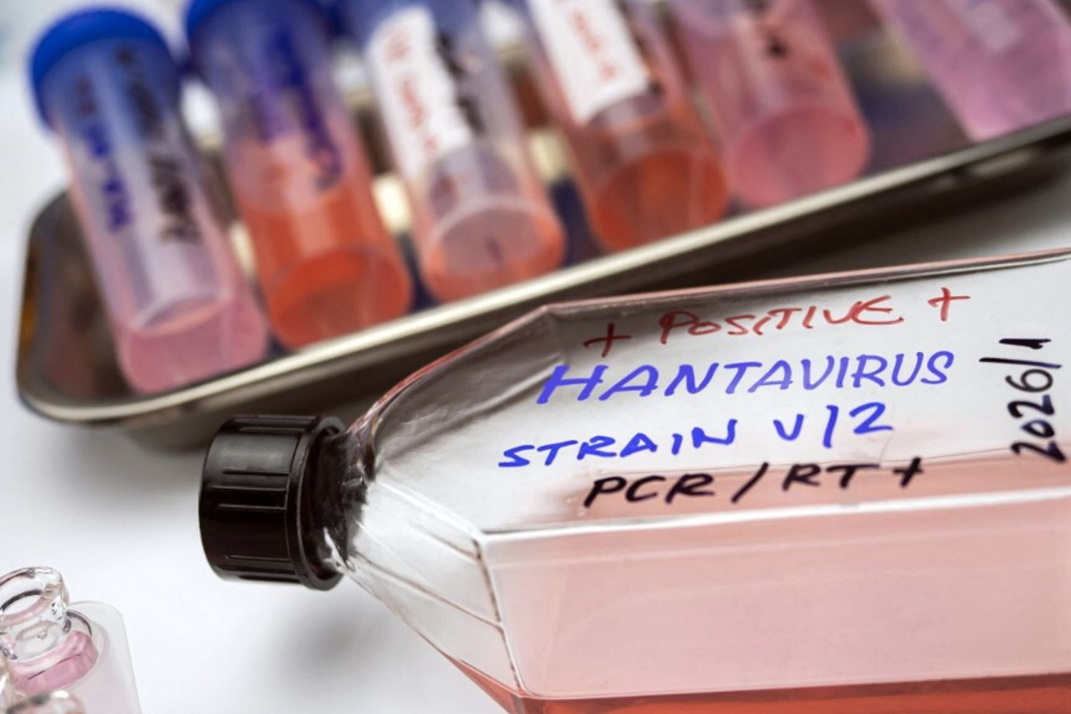 Hantavirus