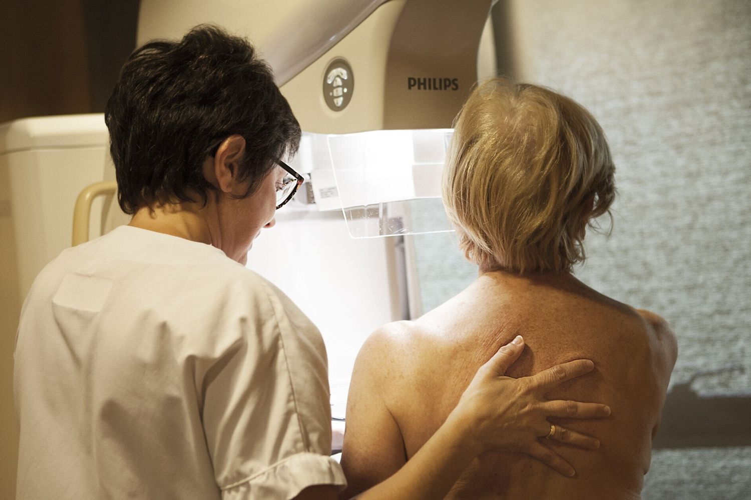 L'IA individua i tumori al seno fino a 6 anni prima