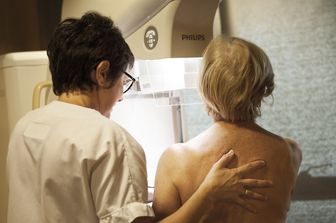 L'IA individua i tumori al seno fino a 6 anni prima