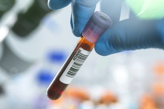 Test del sangue