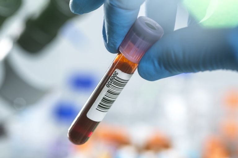 Test del sangue