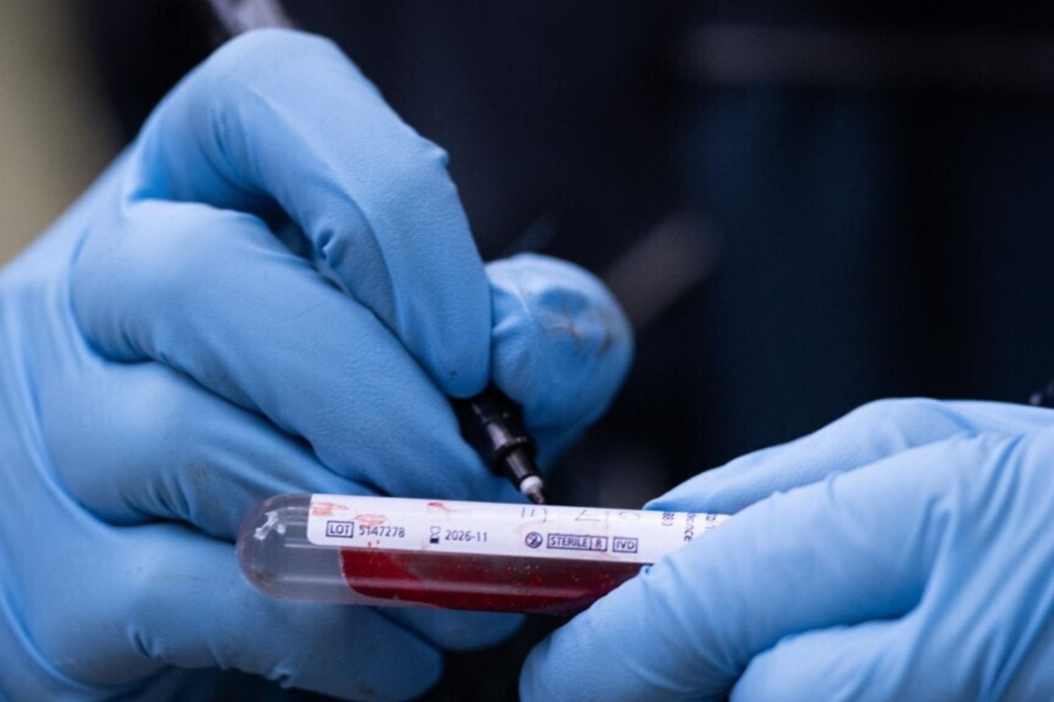 Test del sangue