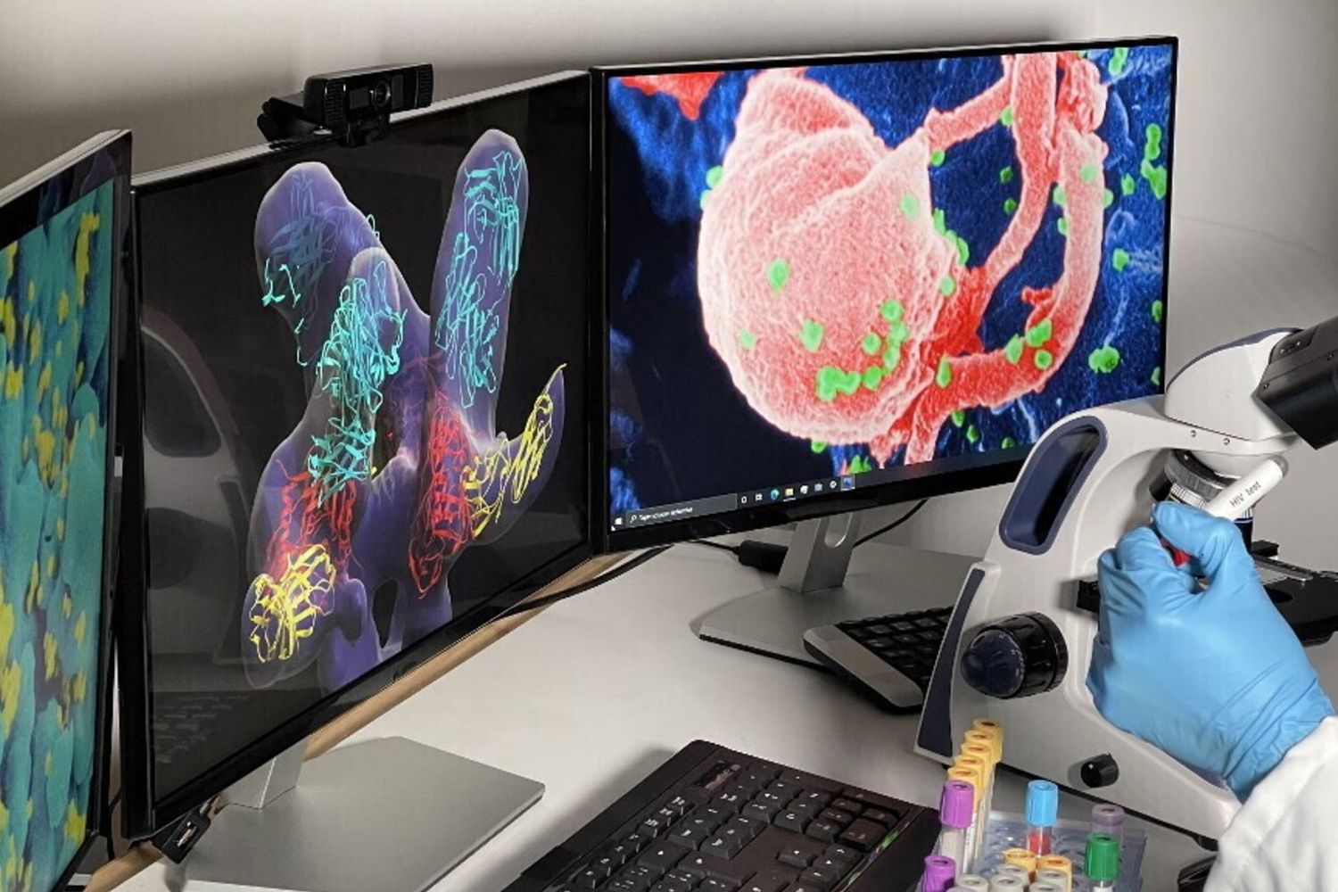 Ricerca su Hiv